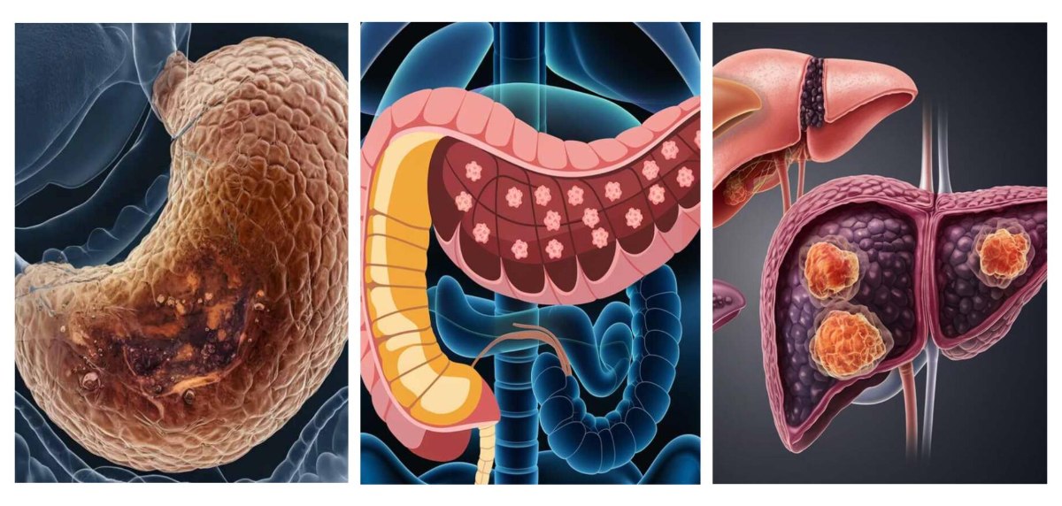 Different Cancers Affect Vitamin B12 